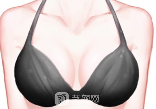 刘月更丰胸技术怎么样?深