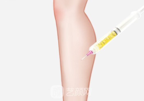 九院薛珂抽脂肪怎么样?附