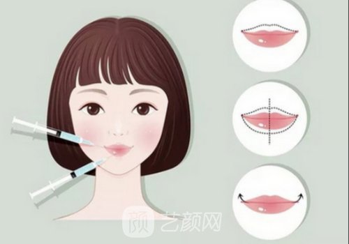 伊婉c可以丰唇吗?维持时间