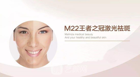 M22带头之冠